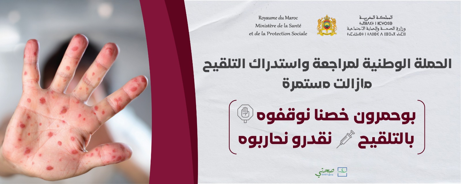 حملة التطعيم المتقدمة للحد من وباء الحصبة..خطة عمل تم وضعها بإقليم إفران  