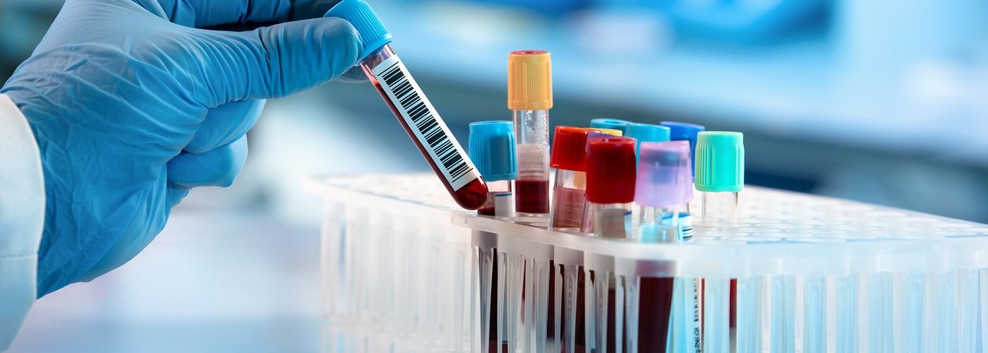 اكتشاف فصيلة دم جديدة