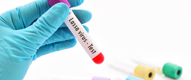 فيروس لاسا virus lassa