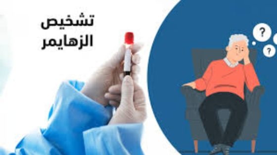 الولايات المتحدة تجيز أول فحص دم لتشخيص الزهايمر.. خطوة ثورية لمحاربة المرض