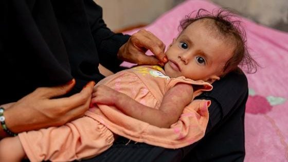 التقرير العالمي حول أزمات الغذاء: معاناة حوالي 300 مليون مليون شخص حول العالم من الجوع الحاد 