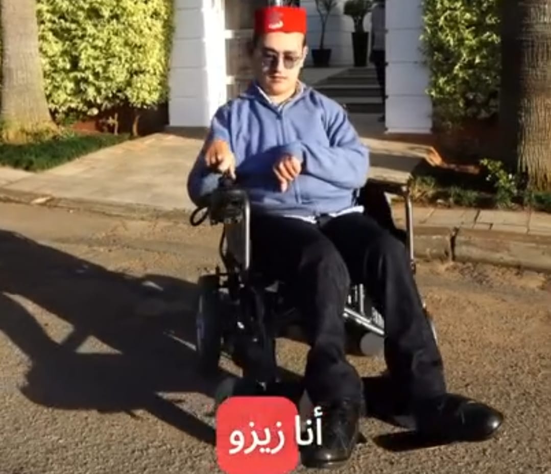 زيزو ..نموذج ناجح لتحدي الإعاقة