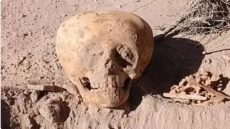 جمجمة مشوهة تثير دهشة الخبراء في الأرجنتين: طقس قديم أم لغز من الماضي؟