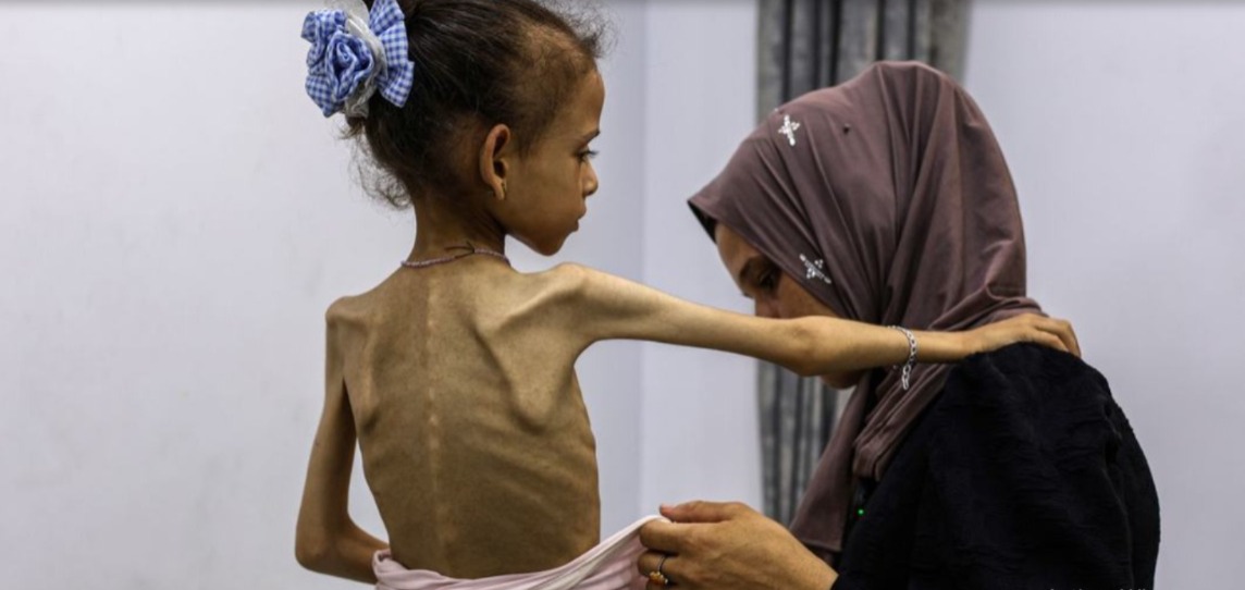 رسميا.. الأمم المتحدة تعلن المجاعة في غزة