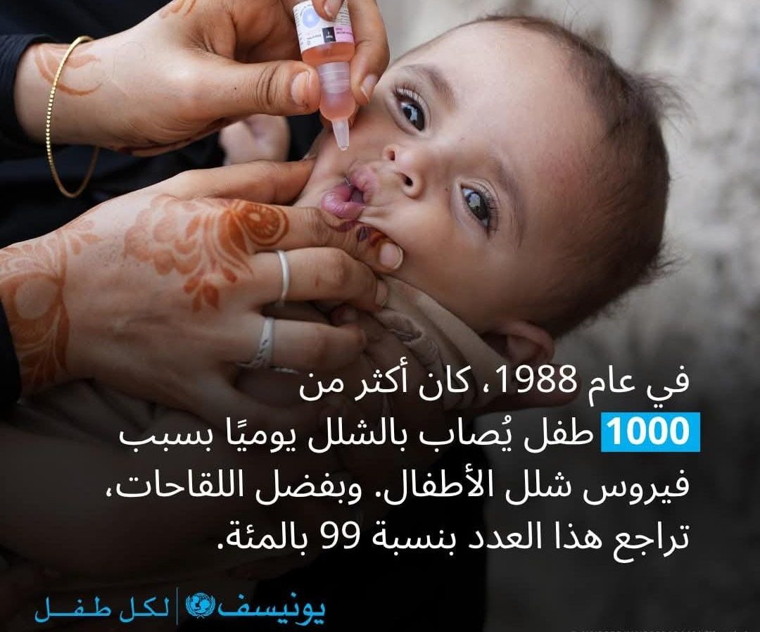 اليونيسف: القضاء على شلل الأطفال ليس حلما