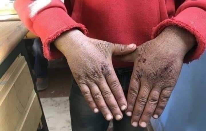 من دفء التضامن في الحوز إلى دفء الجبال.. دعوة إلى حملات مبكرة قبل أن يطرق البرد الأبواب